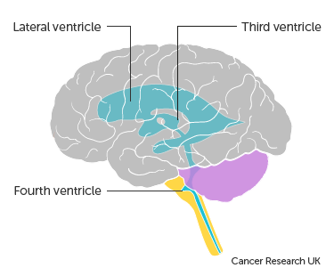 Don't assume everything is just a post stroke symptom